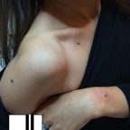 Microdermalpiercing3.jpg